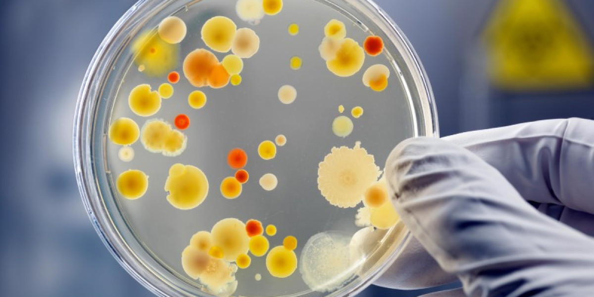 Global Bacterial Cell Culture Market Report, Trends, Industry Opportunity & Forecast Report to 2032