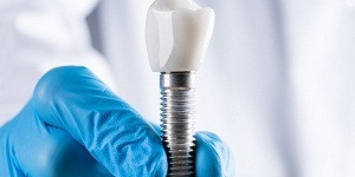 Discover the Amazing Benefits of Dental Implants: Your Ultimate Guide to a Radiant Smile