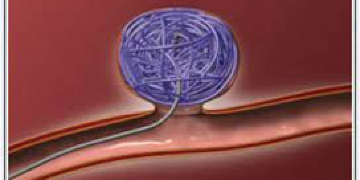 Embolization Coils Market: Future Opportunities, Analysis & Outlook Report to 2032
