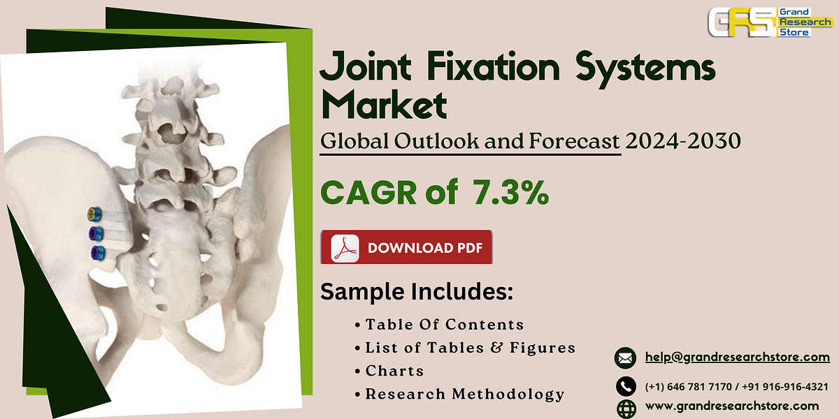 Joint Fixation Systems Market, Global Outlook and Forecast 2024–2030 - Naikdipti - Medium