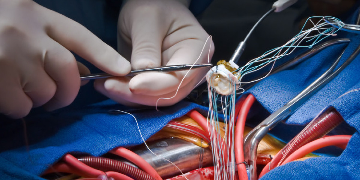 Transcatheter Heart Valve Market will be US$ 17.58 Billion by 2032
