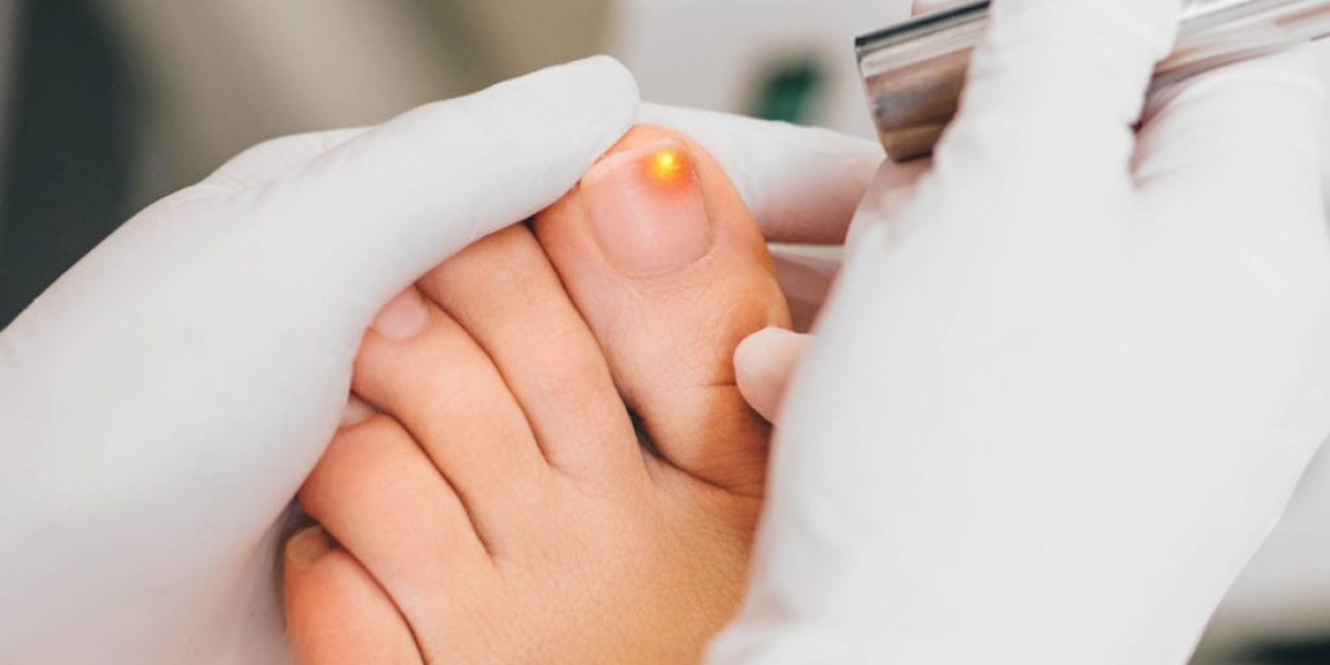 Metanail Reviews: How To Safe Nail Fungus Remover & Use It?