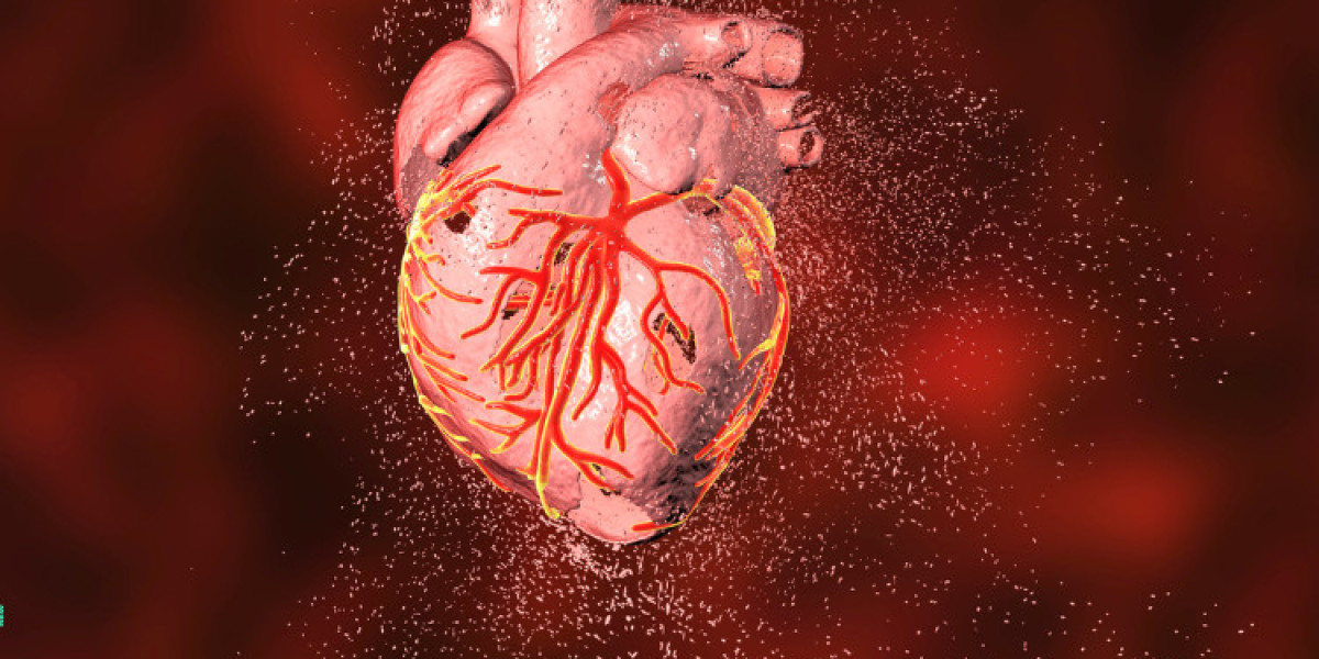 Myocardial Infarction Market Size and Global Forecast Report 2024-2032