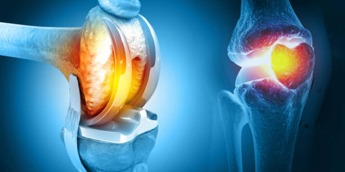 Gadge Hospital: Leading the Way in Total Knee Replacement Surgery in Nagpur