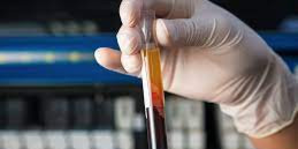 Prothrombin Time Testing Market Size, Growing Trends and Industry Demand Report to 2032