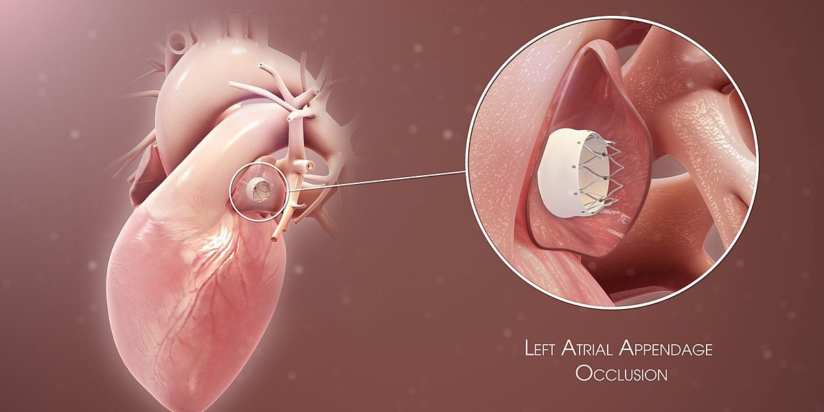 Left Atrial Appendage Closure Device Market | Global Industry Growth, Trends, and Forecast 2023 - 2032