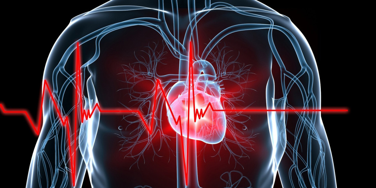 Cardiovascular Devices Market Key Players and Global Industry Demand by 2034