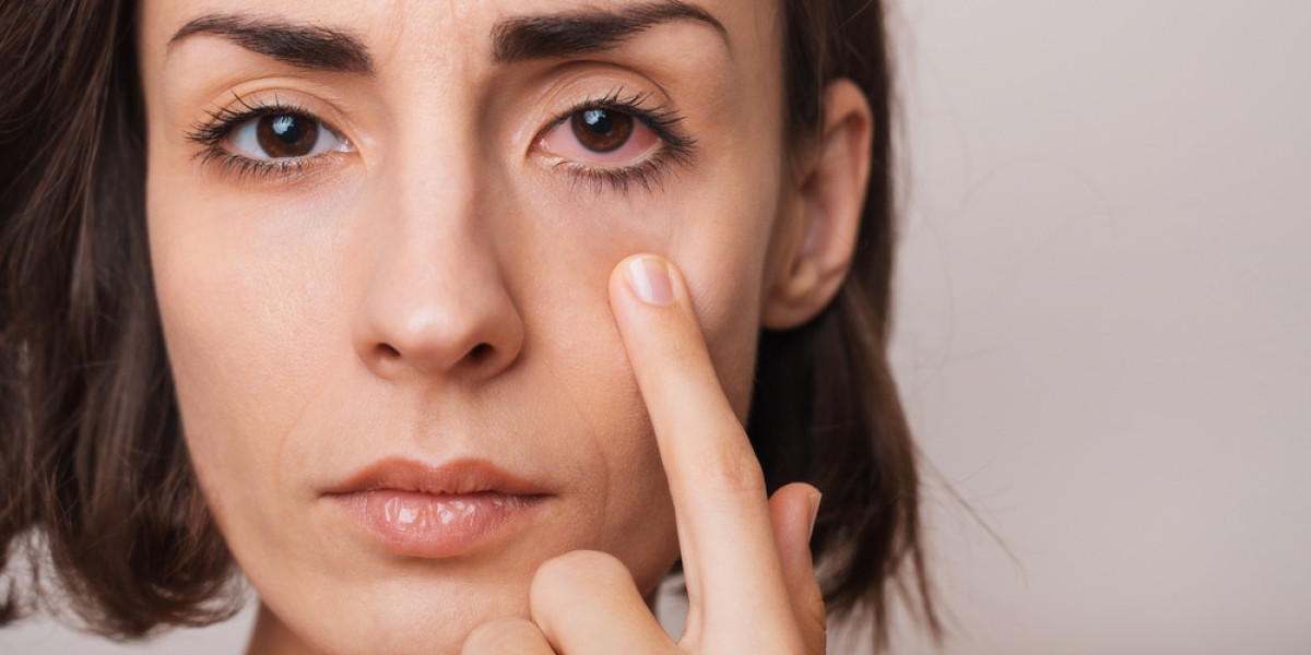 Conjunctivitis Treatment Market Outlook (2024-2031)