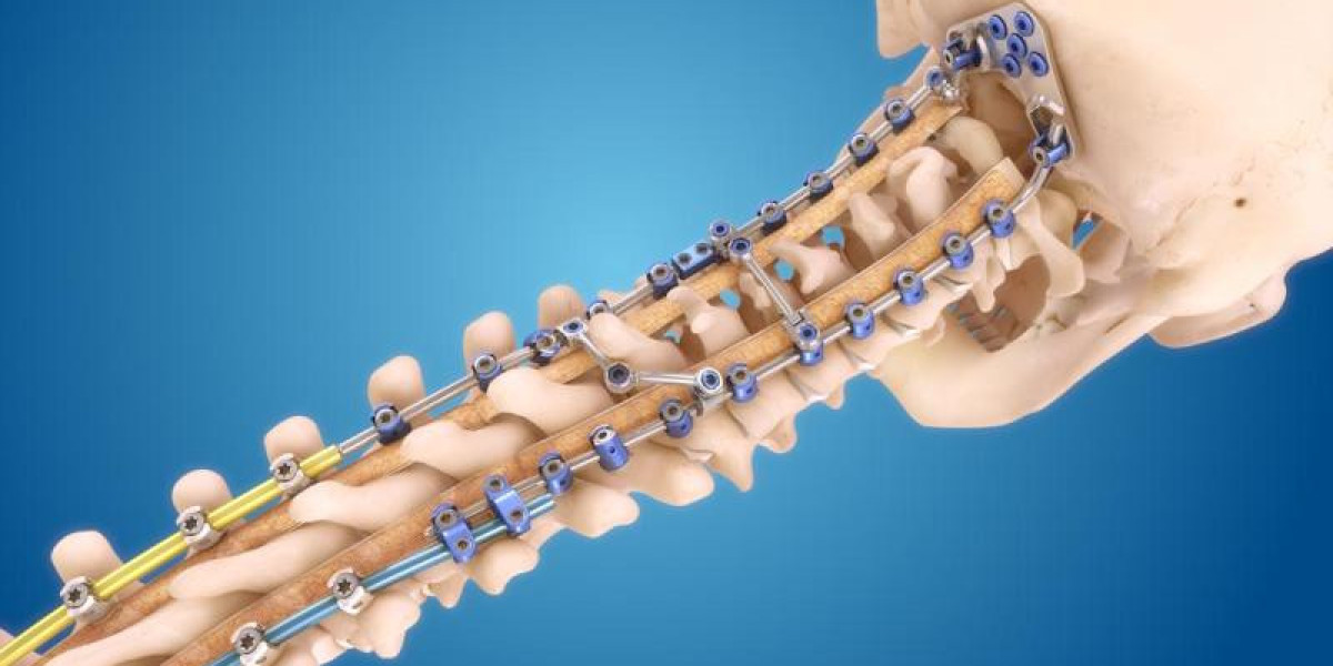 Global Spinal Implants and Devices Market Size, Share, Forecast 2022 – 2032