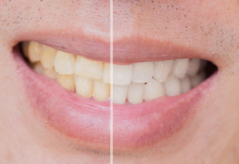 Get personalized care and treatments for your dental issues - Engraving Plus