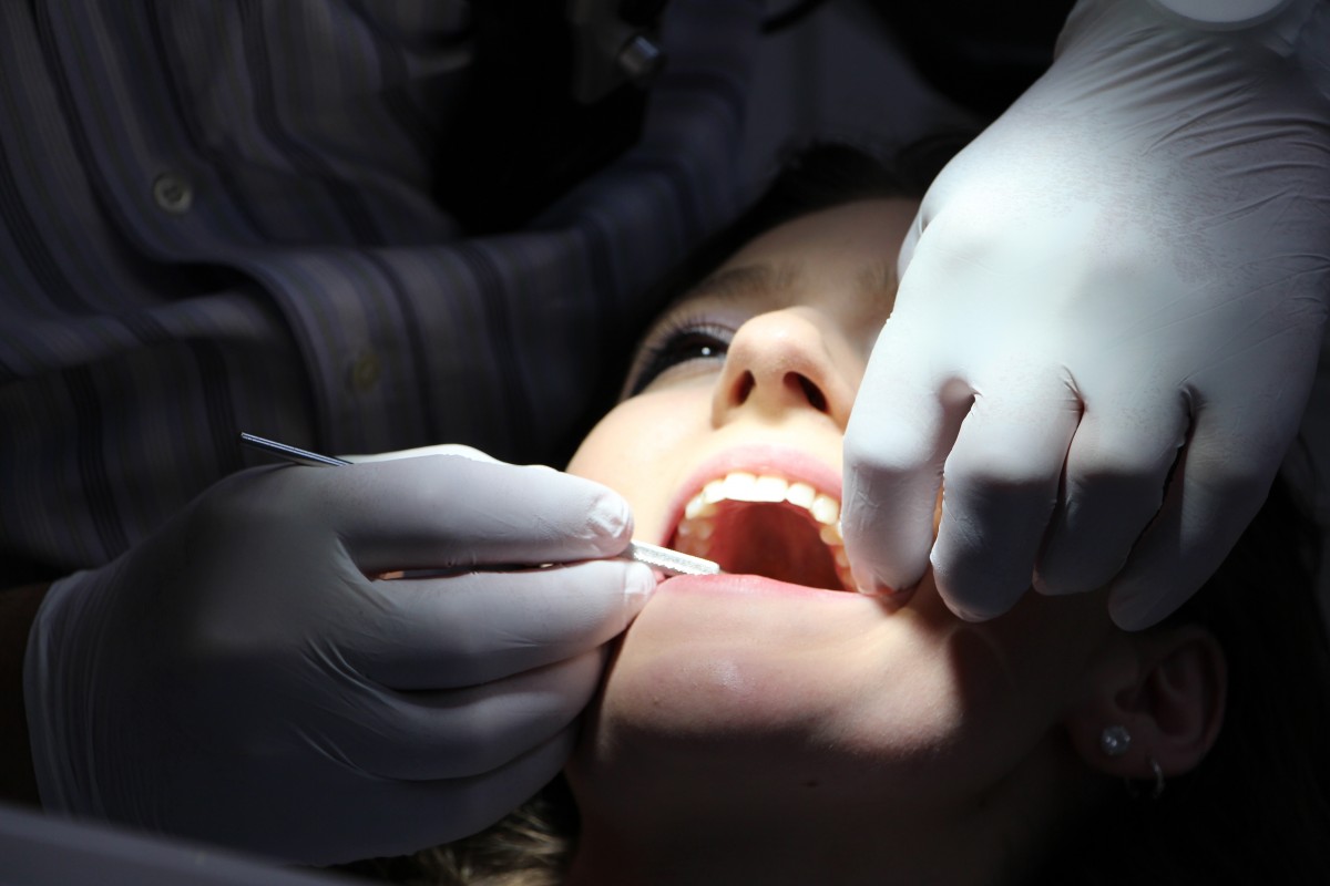 Eradicate your major oral problem via wisdom teeth dental treatment - Timber