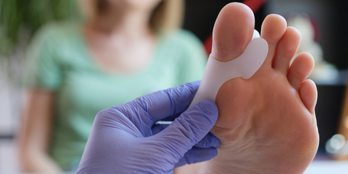 10 Emerging Bunion Treatment Providers: Advancing Medical and Surgical Innovations