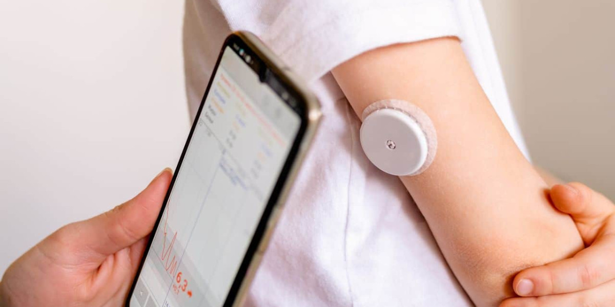 Continuous Glucose Monitoring (CGM) Devices Market Industry, Forecast, and Outlook (2024-2031)