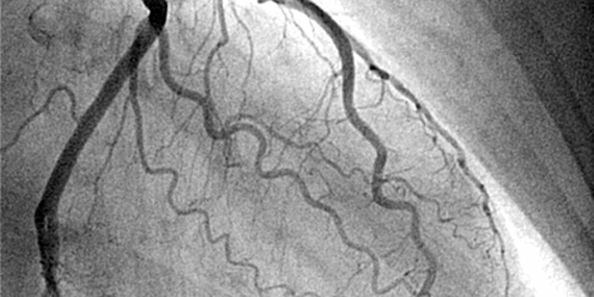 Understanding Coronary Angiography in Jaipur