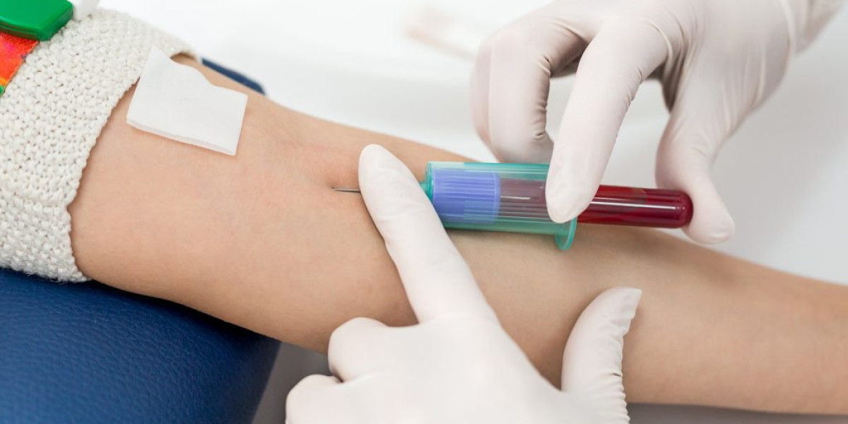 Blood Screening Market Size, Share, Industry, Forecast, and Outlook (2024-2031)