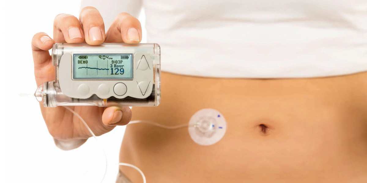 Advancing Diabetes Care: A Comprehensive Analysis of the Global Insulin Infusion Pumps Market