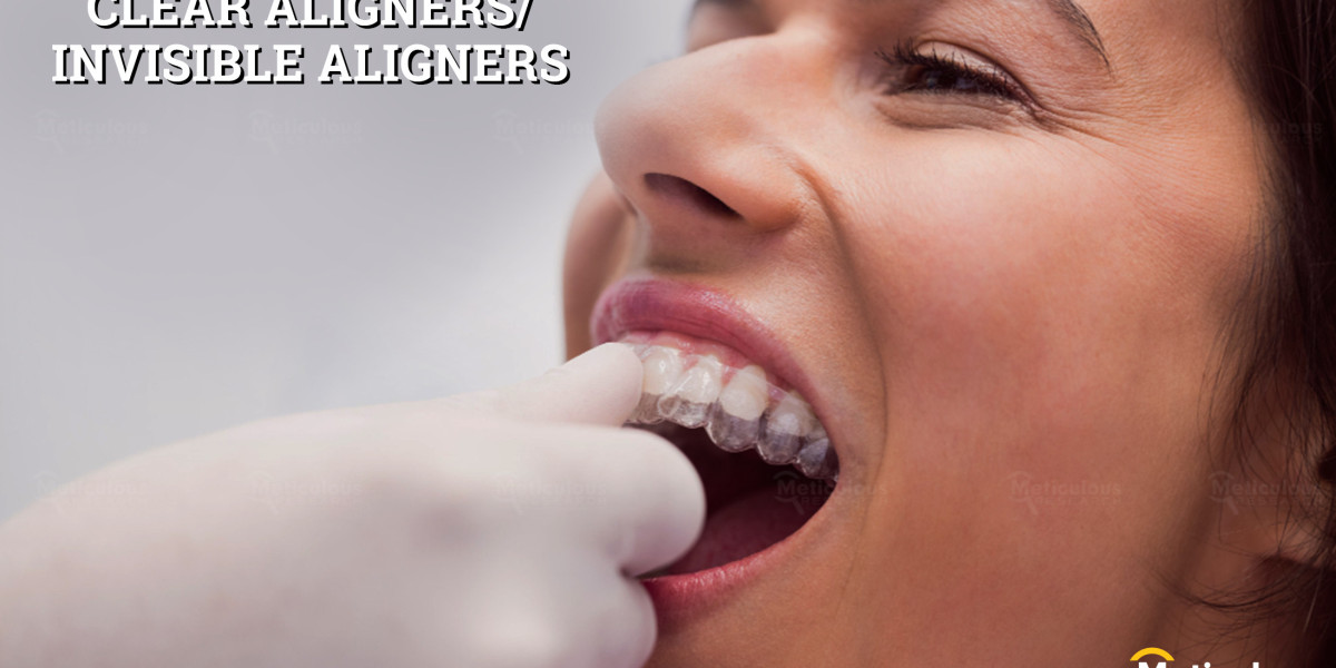 Asia-Pacific Clear Aligners Market to Hit $5.24B by 2030