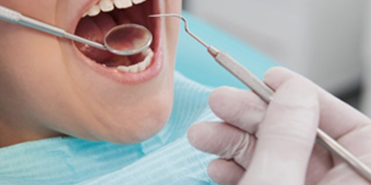 Global Dental Consumables Market: Key Trends and Innovations in Oral Care