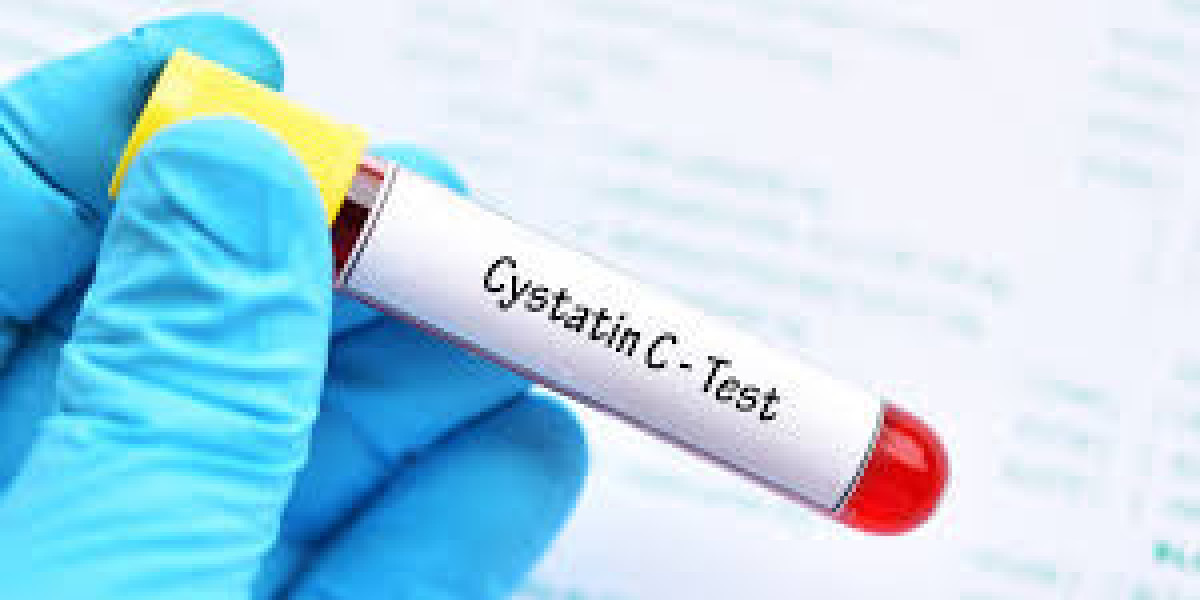 Global Cystatin C Assay Market Growth, Analysis and Forecast 2023 - 2033