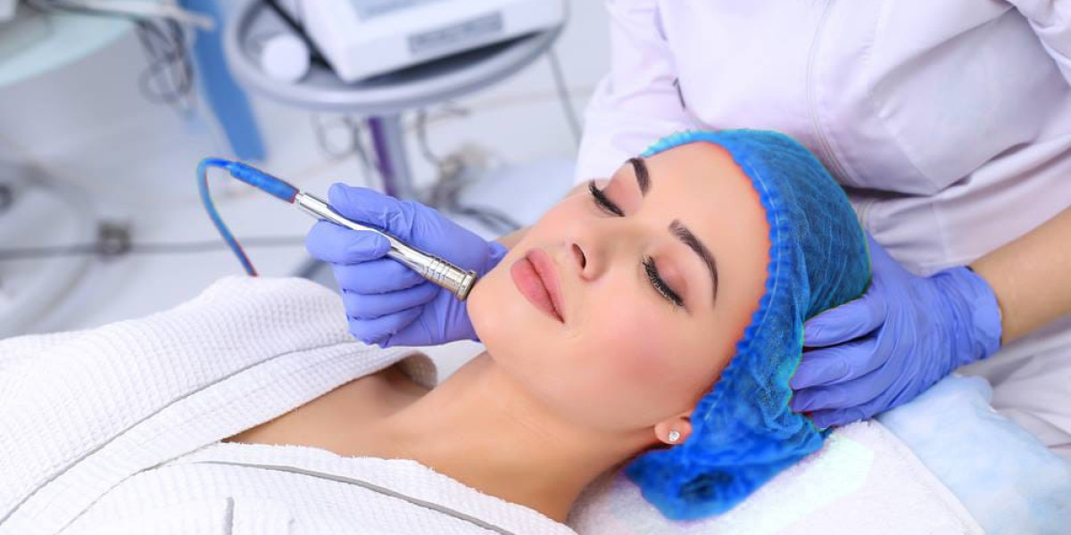 Peeling facial: qué es, para qué sirve y resultados del tratamiento