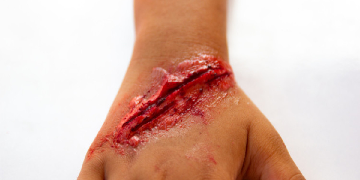 Wound Care Market Size And Forecast Report 2024-2030