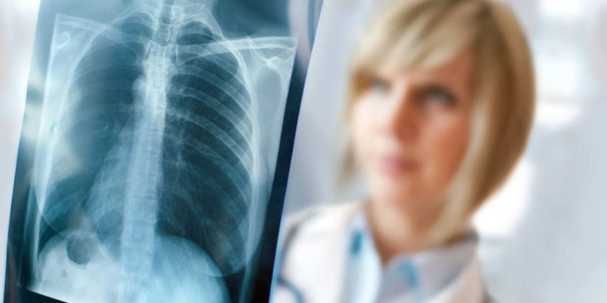 Managing Asthma with Urgent Care Pros