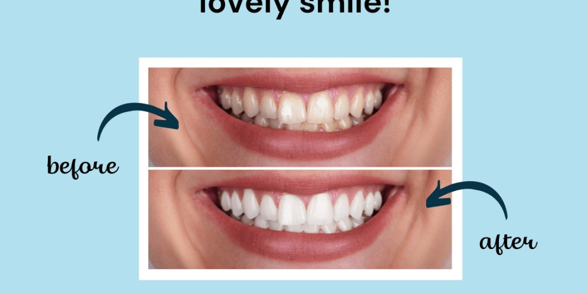 Best Dentist in Vasant Kunj: Dental Arche – Your Trusted Oral Health Partner