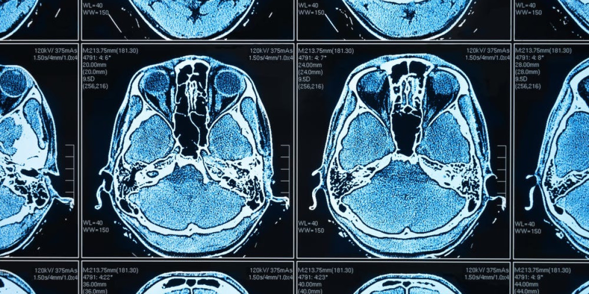 Multimodal Imaging Forecast and Outlook (2024-2031)