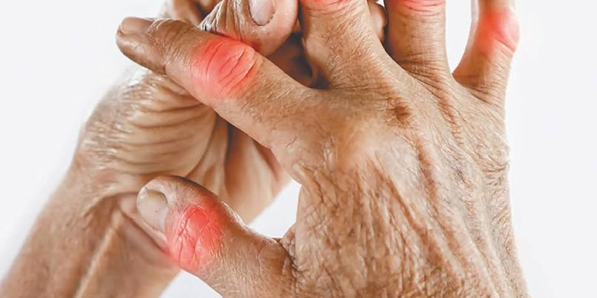 Rheumatoid Arthritis Market Players Adapt Strategies to Navigate Regulatory Changes