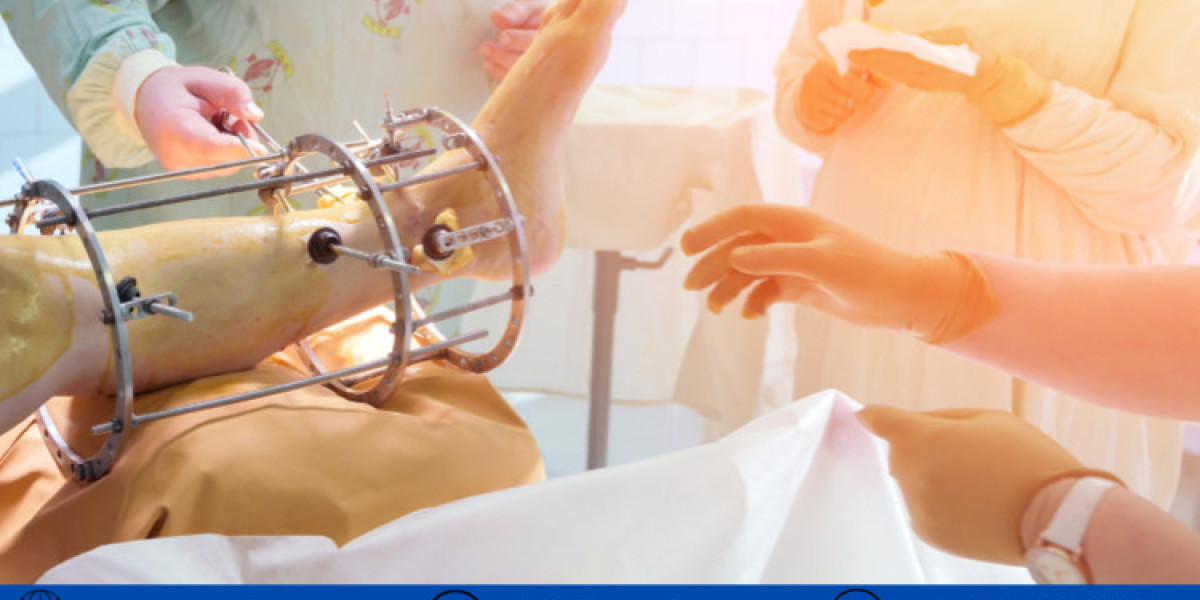 Trauma Fixation Device Market Size And Forecast Report 2024-2032