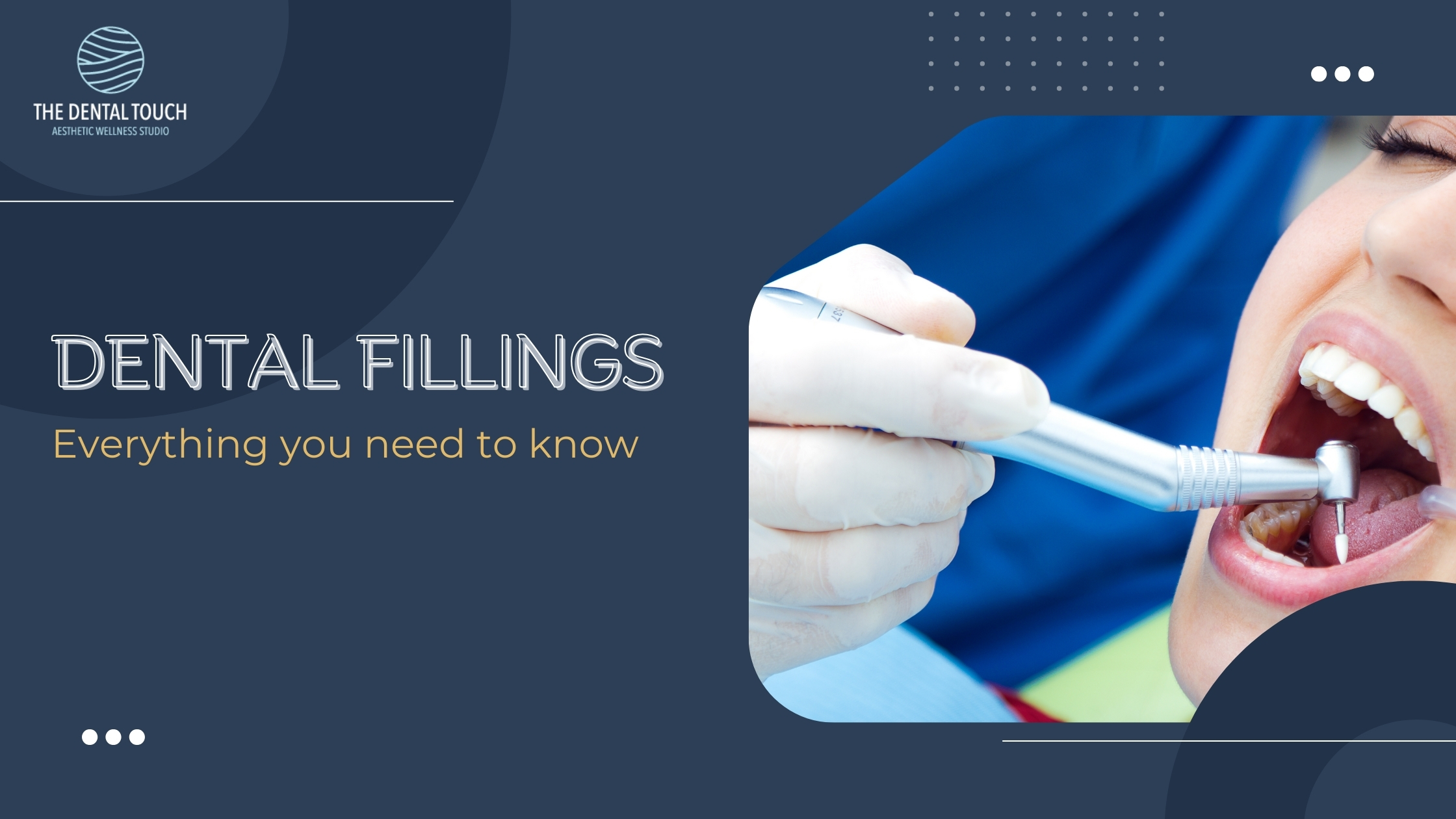 Dental Fillings: Everything You Need to Know for a Healthy Smile