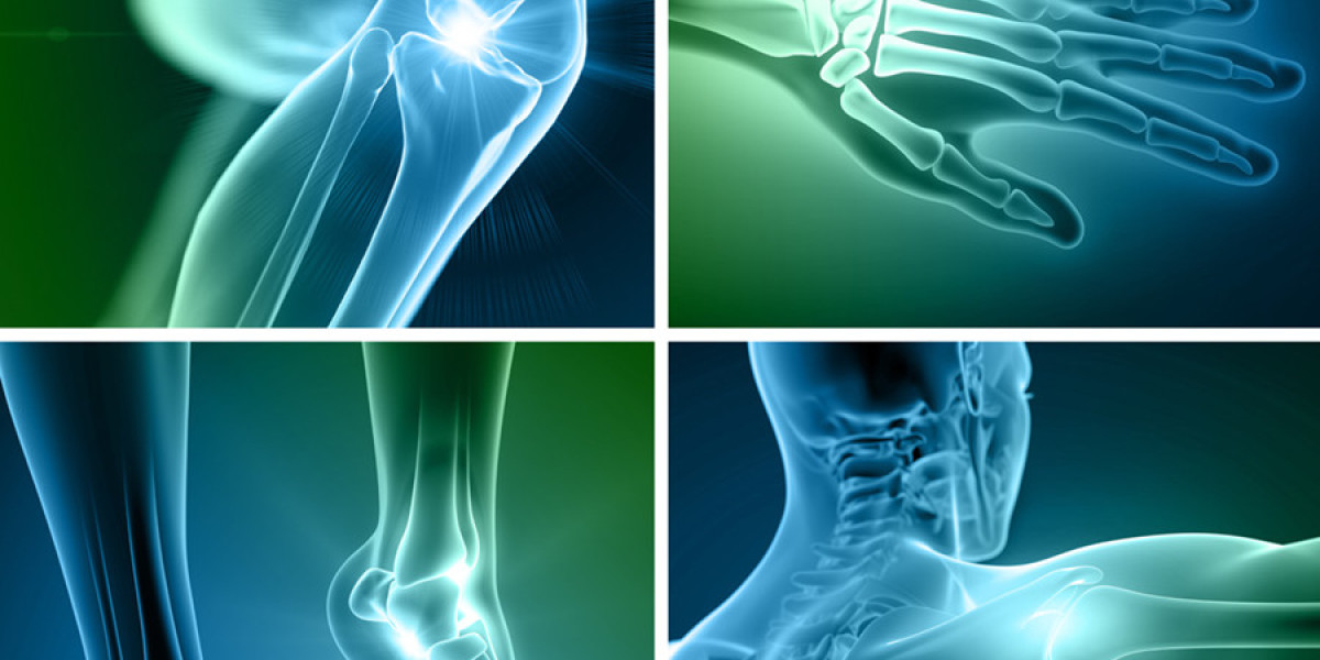 Orthopedic Digit Implants Market Forecast and Outlook (2024-2031)