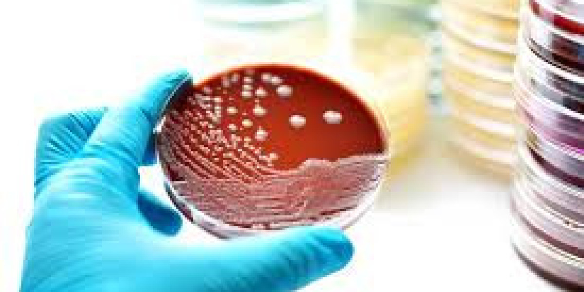 Legionella Testing Market 2023 Global Industry Analysis With Forecast To 2032