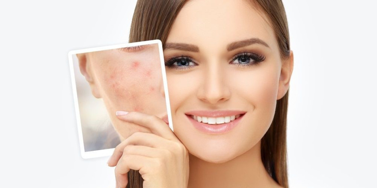 Scar Treatment Market Size, Share, Industry, Forecast and Outlook (2024-2031)