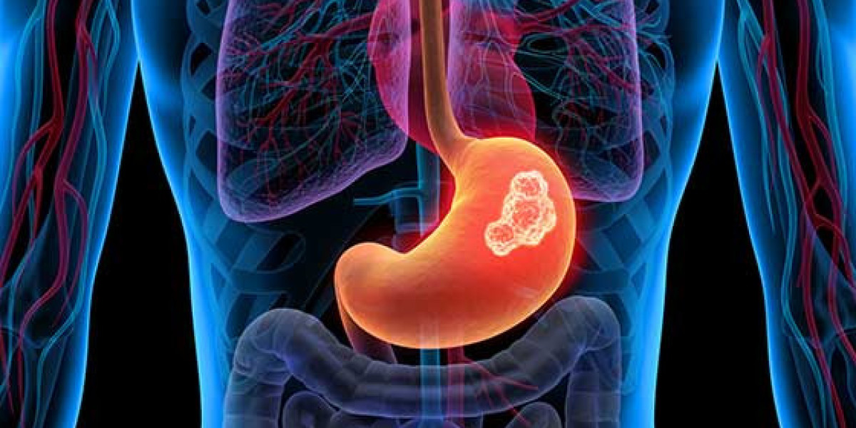 Chromoendoscopy Agent Market Size, Forecast and Outlook (2024-2031)