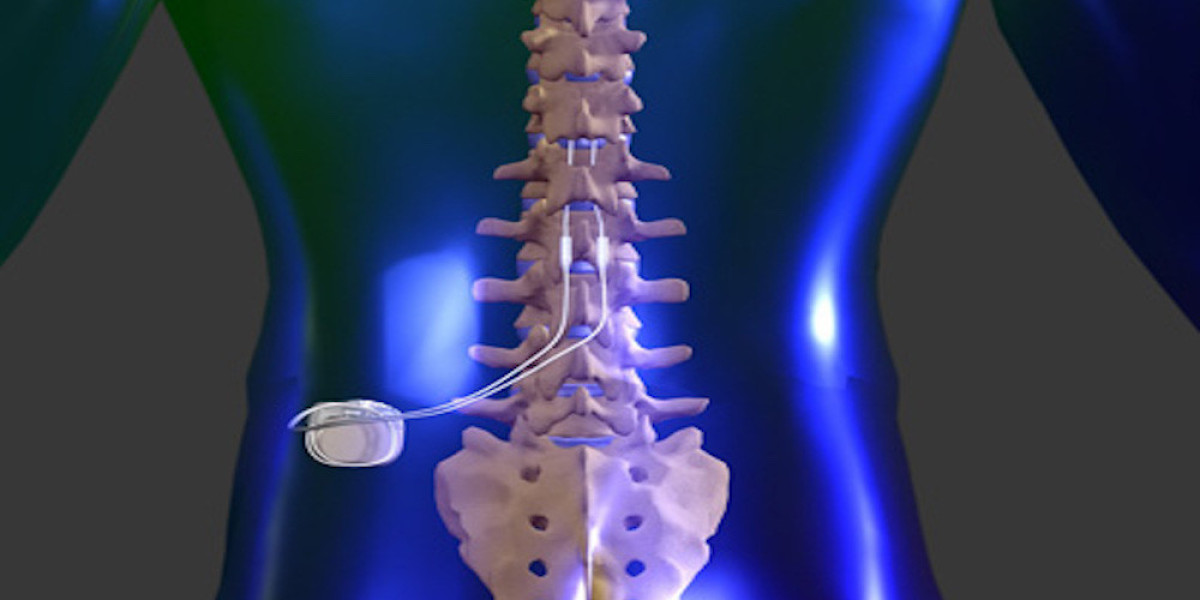 Spine Implants Market Regional Share, Trends, and Forecast by 2031