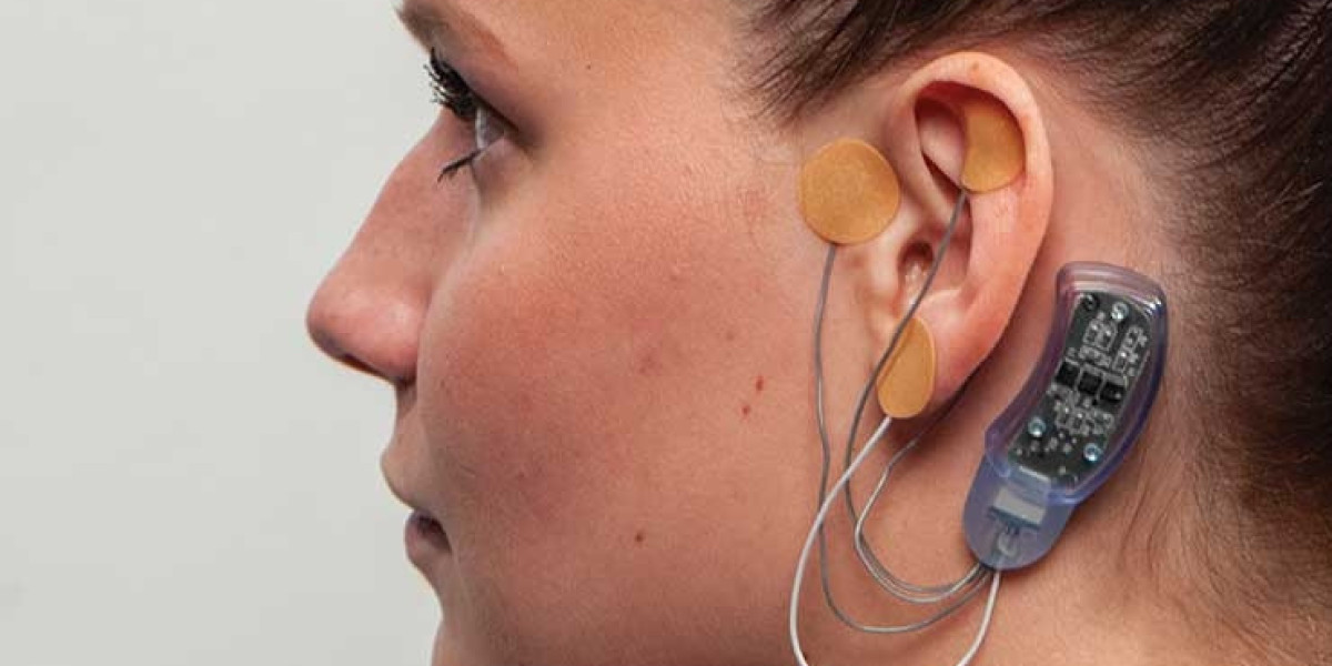Neurostimulation Devices Market Size, Share, Industry, Forecast, and Outlook (2024-2031)