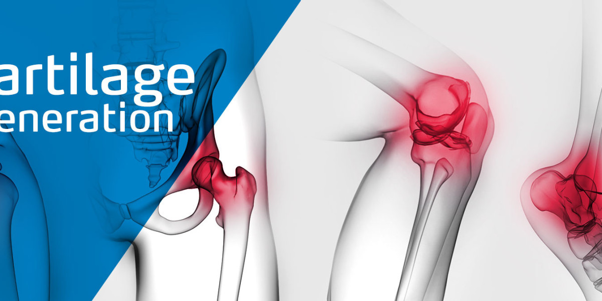 Technological Advancements in Tissue Engineering Boost Cartilage Repair Regeneration Market Growth