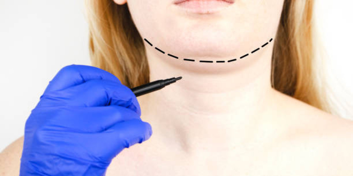 Double Chin Removal: Exploring Effective Treatments and Lifestyle Solutions