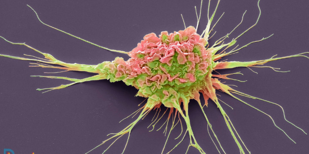 Innovations in HR+/HER2- Breast Cancer Treatment: What Patients Should Know