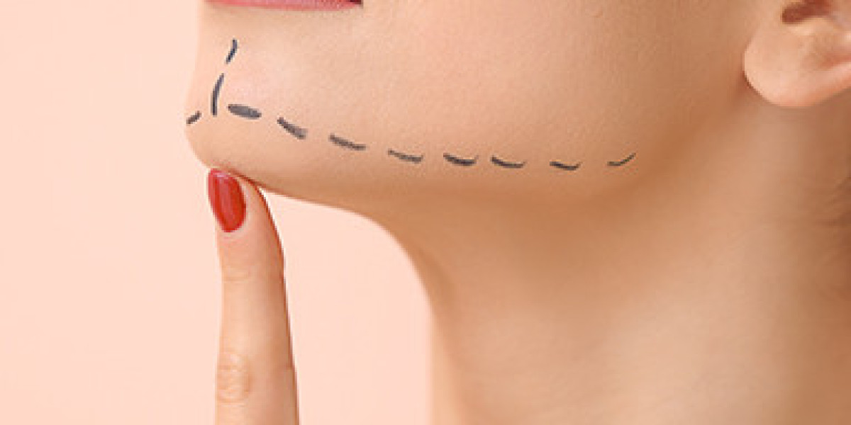 Double Jaw Surgery: What It Is and When It’s Needed