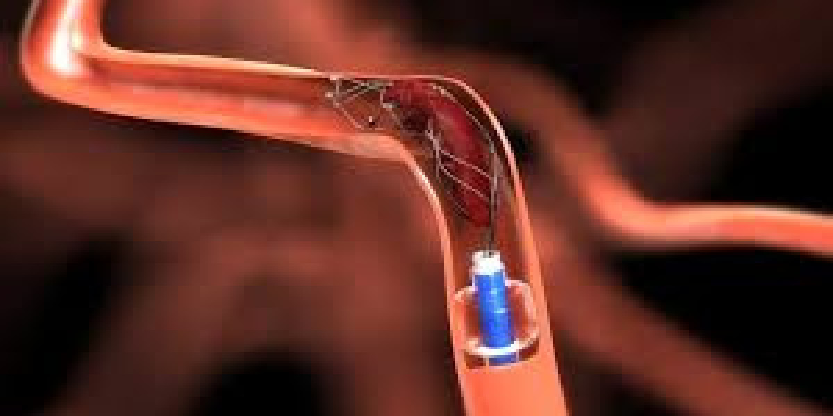 Global Neurovascular Devices Market Size, Share,  Forecast 2022 – 2032