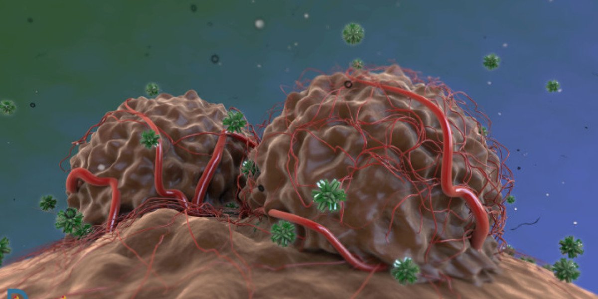 Navigating the NASH Spectrum: From Diagnosis to Disease Progression