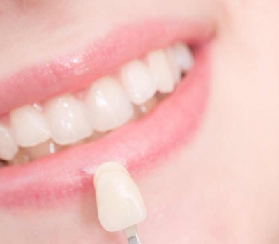 Grab the most ultimate process of getting porcelain veneers dental treatment - Wiki Blog