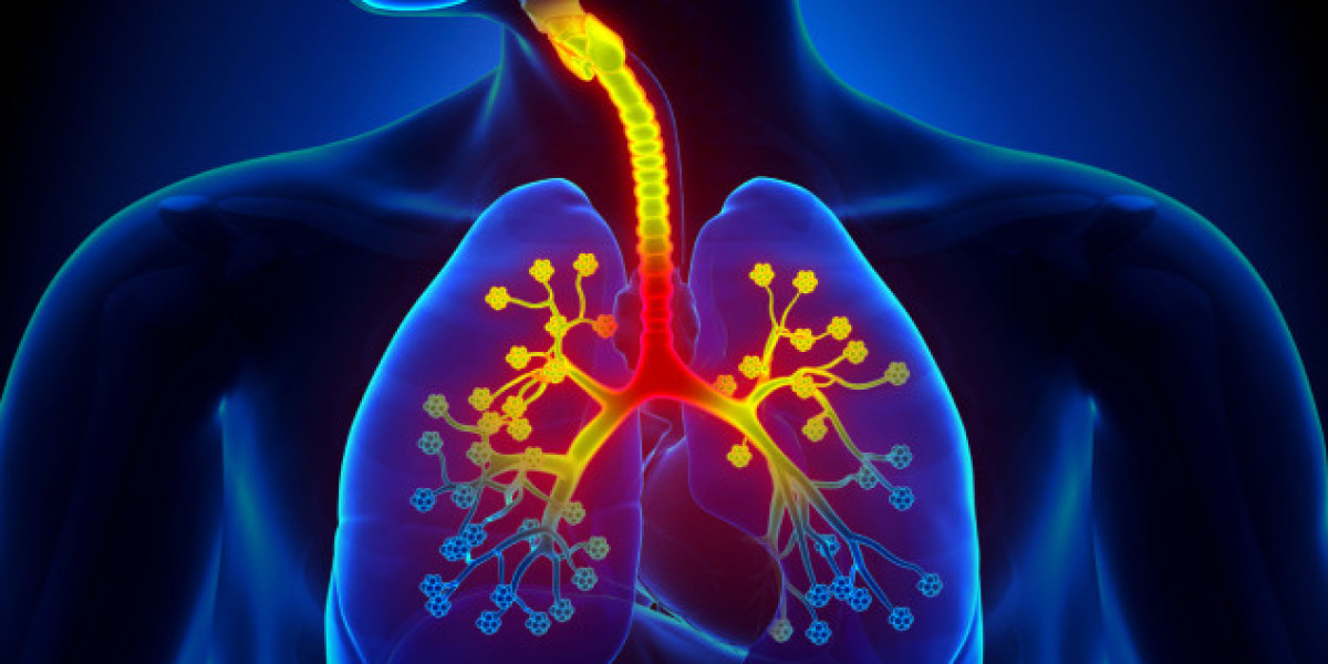 Research Report on the Diffusive Alveolar Hemorrhage Treatment Industry