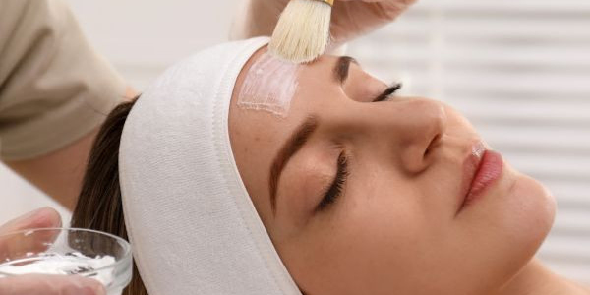 DIY Chemical Peel Kits: Are They Safe?