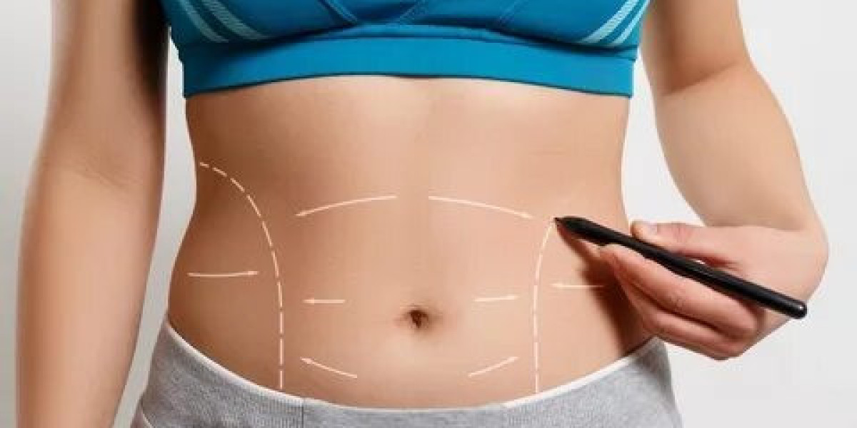 Tummy Tuck vs. Mini Tummy Tuck: Which Is Right for You?