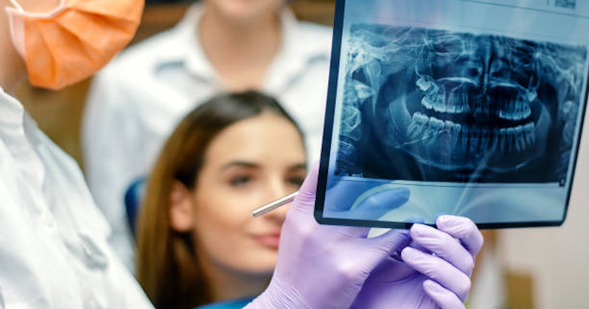 How to Identify Donvale's Top Dental Implant Specialist