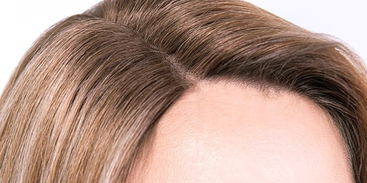 Hair Toppers for Women: The Perfect Solution for Thinning Hair