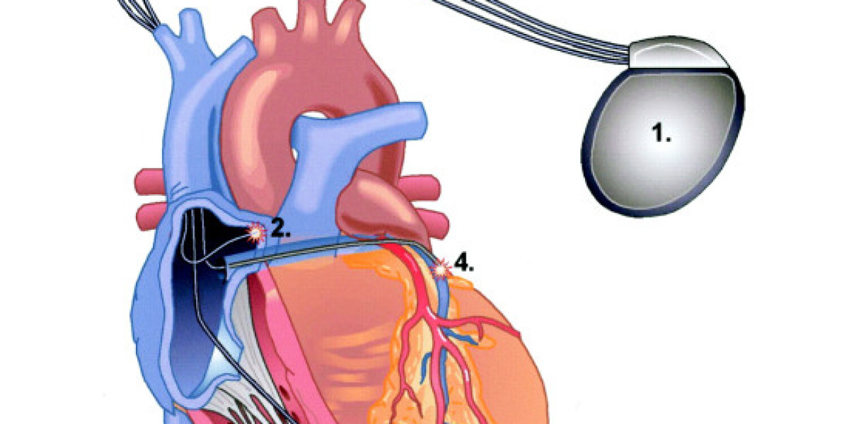 Cardiac Resynchronization Therapy Devices Market Share & Forecast Report to 2032